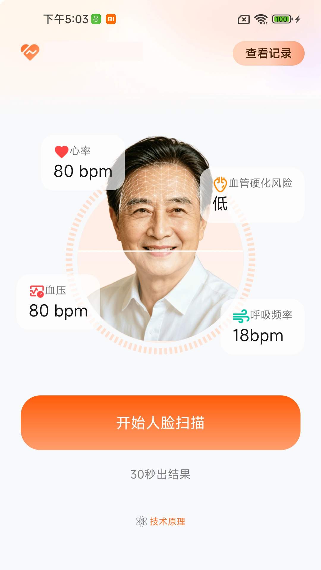 AI心率健康检测仪定制版