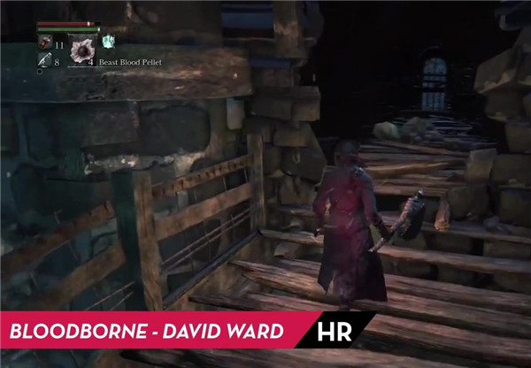 《血源》含笑半步癫BUG 酷炫狂拽抽搐舞步