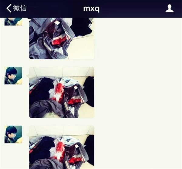 被滴滴司机挑断手筋的电竞选手 原来获奖有这么多