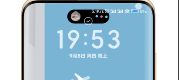 小米手机怎么设置灵动岛