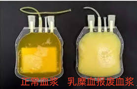 献血者献出的血液能直接输注给病人吗