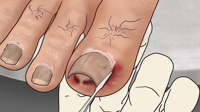 修脚足疔模拟器最新版