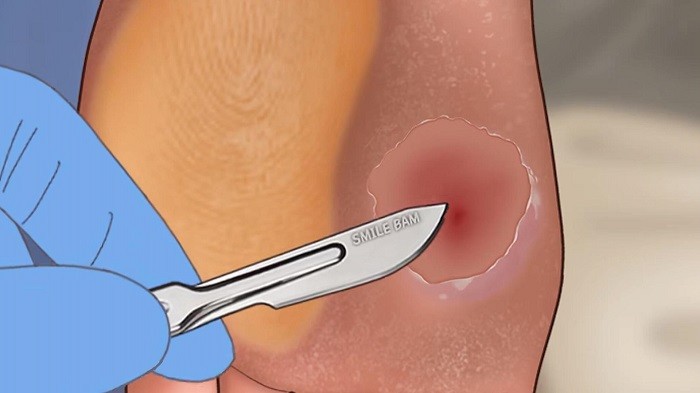 修脚足疔模拟器汉化版