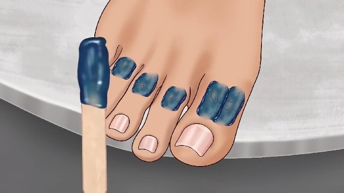 修脚足疔模拟器免广告版