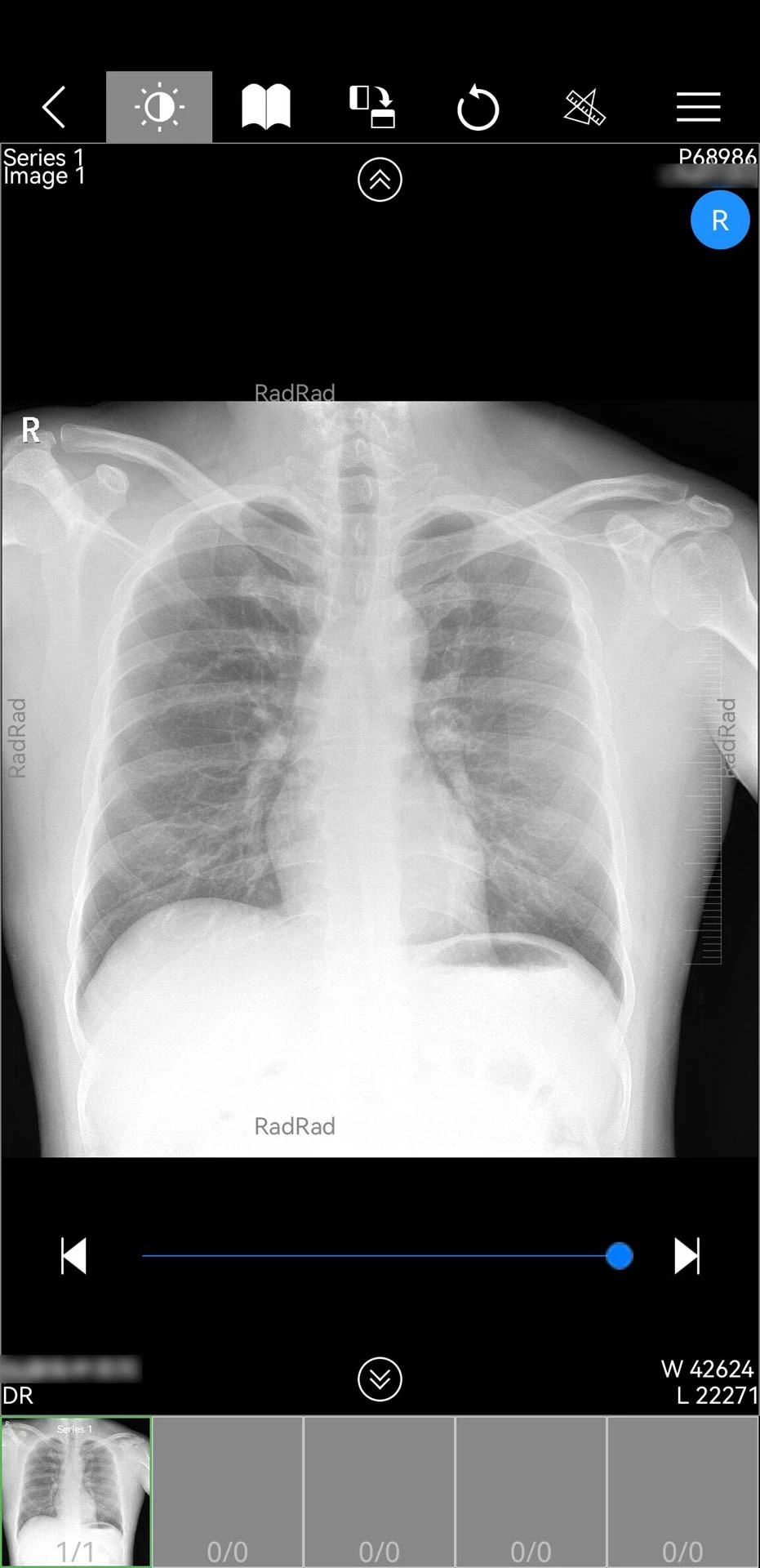 微影医生老版本