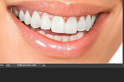 PS牙齿变白如何设置？PS牙齿变白设置方法介绍